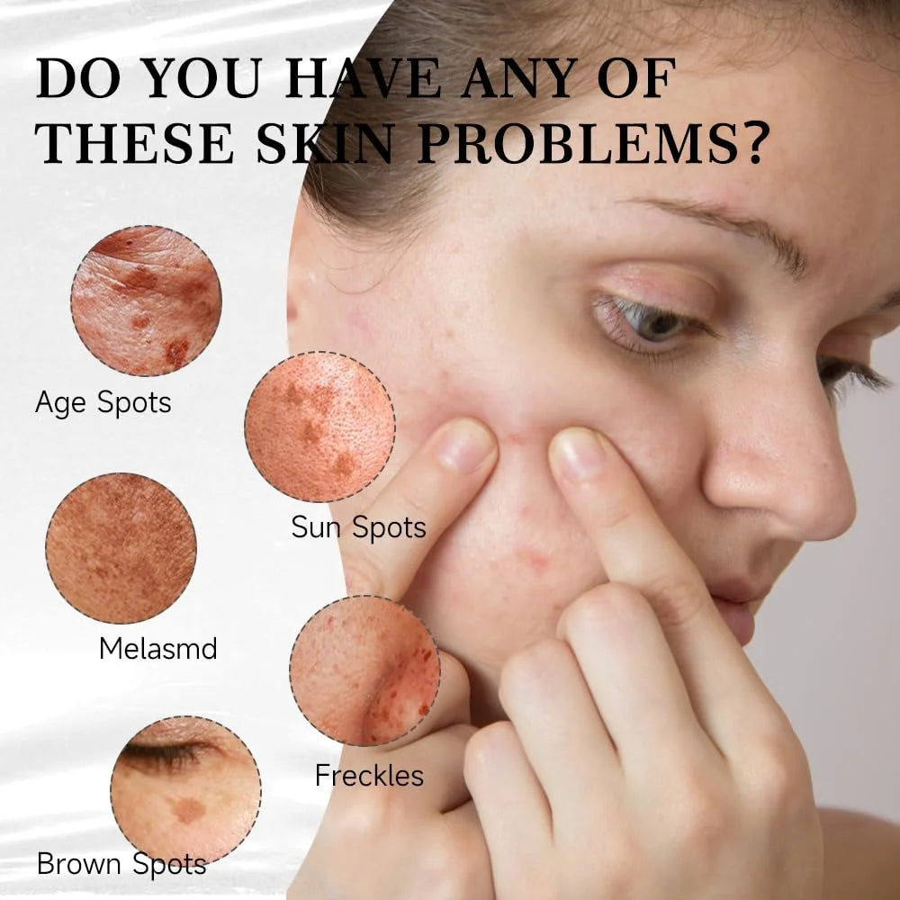 Dark Spot Remover for Face & Body |
Advanced Corrector Serum
